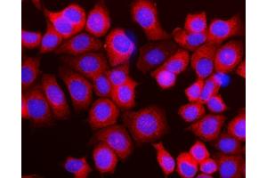 IF analysis of RPL10 using anti-RPL10 antibody (ABIN7601177).