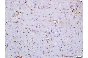 Formalin-fixed and paraffin embedded rat brain labeled with Anti-SV2A Polyclonal Antibody, Unconjugated  at 1:200 followed by conjugation to the secondary antibody and DAB staining