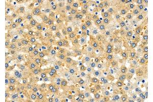 ABIN6264773 and ABIN6278630 at 1/100 staining Rat liver tissue by IHC-P. (URI1 Antikörper  (Internal Region))