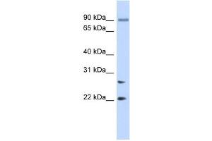 JOSD2 antibody used at 1 ug/ml to detect target protein.