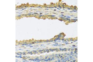 Immunohistochemistry of paraffin-embedded human prostate using TSHB antibody.