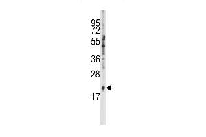 Western blot analysis of anti-SNRPC Antibody (C-term) (ABIN389354 and ABIN2839460) in K562 cell line lysates (35 μg/lane). (SNRPC Antikörper  (C-Term))