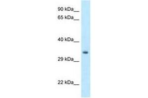 Image no. 1 for anti-Homeobox C11 (HOXC11) (C-Term) antibody (ABIN6747866) (HOXC11 Antikörper  (C-Term))