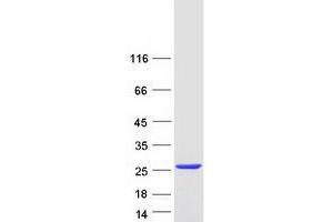 Validation with Western Blot (APRT Protein (Transcript Variant 1) (Myc-DYKDDDDK Tag))
