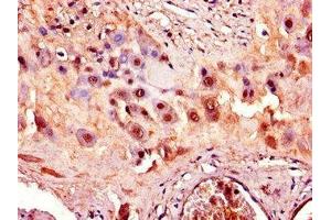 Immunohistochemistry of paraffin-embedded human placenta tissue using ABIN7150038 at dilution of 1:100 (ADAM12 Antikörper  (AA 730-909))