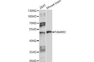 Western blot analysis of extracts of various cell lines, using FAM46C antibody (ABIN6292917) at 1:1000 dilution. (FAM46C Antikörper)