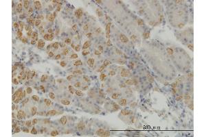 Immunoperoxidase of monoclonal antibody to AATK on formalin-fixed paraffin-embedded human stomach. (AATK Antikörper  (AA 161-260))
