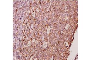 Immunohistochemistry analyzes of AP20378PU-N Ephrin-A1 antibody in paraffin-embedded human tonsil carcinoma tissue at 1/50. (Ephrin A1 Antikörper)