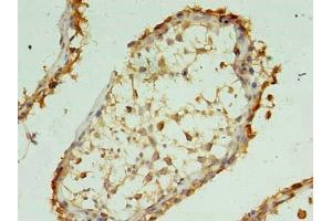 Immunohistochemistry of paraffin-embedded human testis tissue using ABIN7175875 at dilution of 1:100 (XAGE1 Antikörper  (AA 1-81))