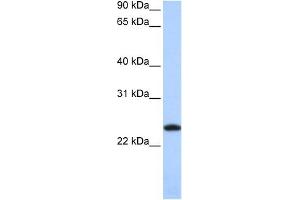 WB Suggested Anti-FTL Antibody Titration: 0. (FTL Antikörper  (Middle Region))