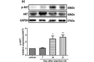 The CXCR7 and PI3K/Akt signaling pathways are involved in CPSP in the dorsal horn of the spinal cord. (GAPDH Antikörper)