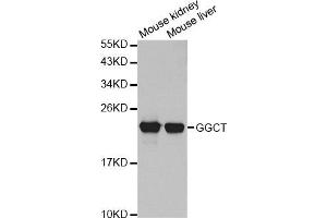Western Blotting (WB) image for anti-gamma-Glutamylcyclotransferase (GGCT) antibody (ABIN1876220) (GGCT Antikörper)