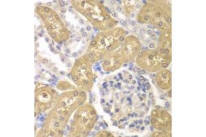 Immunohistochemistry (Paraffin-embedded Sections) (IHC (p)) image for anti-Aldo-Keto Reductase Family 1, Member A1 (Aldehyde Reductase) (AKR1A1) (AA 1-325) antibody (ABIN6136715)