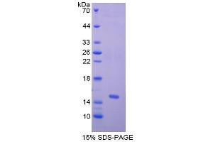 SDS-PAGE (SDS) image for Nephrosis 1, Congenital, Finnish Type (Nephrin) (NPHS1) (AA 23-92) protein (His tag) (ABIN2126030)