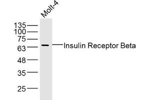 Molt-4 lysates probed with Insulin Receptor Beta Polyclonal Antibody, Unconjugated  at 1:300 dilution and 4˚C overnight incubation. (ISR-beta Antikörper  (AA 1001-1100))