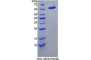 Image no. 1 for Adenosylhomocysteinase (AHCY) (AA 2-432) protein (His tag) (ABIN6237167)