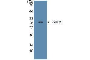 Western blot analysis of recombinant Mouse FBN1. (Fibrillin 1 Antikörper  (AA 957-1143))