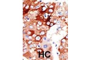Immunohistochemistry (IHC) image for anti-Acyl-CoA Synthetase Long-Chain Family Member 4 (ACSL4) antibody (ABIN3001550) (ACSL4 Antikörper)