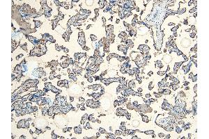 Immunohistochemistry (IHC) image for anti-Ionized Calcium-binding Adapter Molecule 1 (IBA1) (C-Term) antibody (ABIN184738)