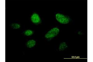 Immunofluorescence of purified MaxPab antibody to C14orf106 on HeLa cell. (MIS18 Binding Protein 1 (MIS18BP1) (AA 1-314) Antikörper)