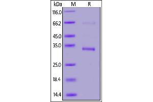 SARS-CoV-2 Envelope protein, GST,His Tag on SDS-PAGE under reducing (R) condition. (SARS-CoV-2 Envelope Protein (SARS-CoV-2 E) (His tag,GST tag))