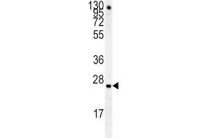 Western Blotting (WB) image for anti-Insulin-Like Growth Factor Binding Protein 4 (IGFBP4) antibody (ABIN3002898)