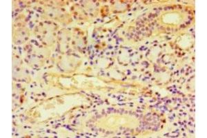 Immunohistochemistry of paraffin-embedded human pancreatic tissue using ABIN7145570 at dilution of 1:100