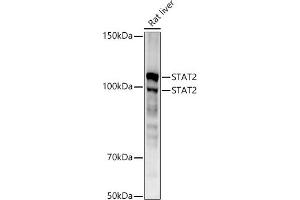 Western blot analysis of extracts of Rat liver, using ST antibody (ABIN1678782, ABIN3017845, ABIN3017846 and ABIN7101526) at 1:1000 dilution. (STAT2 Antikörper)