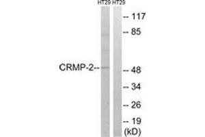 Western blot analysis of extracts from HT-29 cells, treated with heat shock, using CRMP-2 (Ab-509) Antibody. (DPYSL2 Antikörper  (AA 475-524))