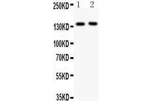 Western Blotting (WB) image for anti-Selectin P (Granule Membrane Protein 140kDa, Antigen CD62) (SELP) (AA 42-271) antibody (ABIN3043327)
