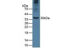 Detection of APOA5 in Mouse Liver Tissue using Monoclonal Antibody to Apolipoprotein A5 (APOA5) (APOA5 Antikörper  (AA 21-210))