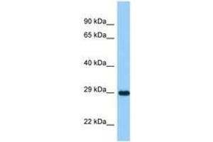 Image no. 1 for anti-Ankyrin Repeat and SOCS Box-Containing 11 (ASB11) (AA 21-70) antibody (ABIN6748270) (ASB11 Antikörper  (AA 21-70))