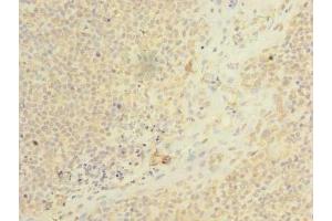 Immunohistochemistry of paraffin-embedded human tonsil tissue using ABIN7158460 at dilution of 1:100 (ARMC9 Antikörper  (AA 401-665))