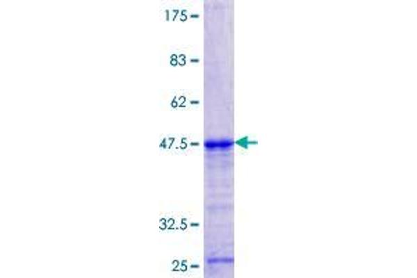 DBR1 Protein (AA 445-538) (GST tag)