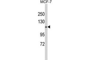 Western Blotting (WB) image for anti-Calponin Homology Domain Containing 2 (CHDC2) antibody (ABIN3003994) (CXorf22 Antikörper)