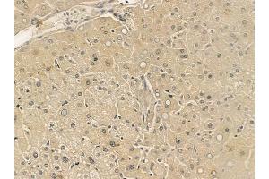 ABIN6265845 and ABIN6273337 at 1/100 staining human normal liver tissue by IHC-P. (UBE2E2 Antikörper  (N-Term))