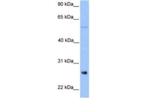 Western Blotting (WB) image for anti-Methyltransferase Like 7B (METTL7B) antibody (ABIN2463256) (METTL7B Antikörper)