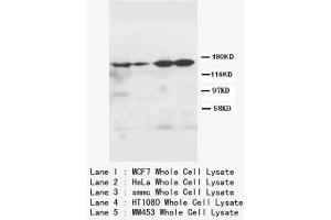 Image no. 2 for anti-rho-Associated, Coiled-Coil Containing Protein Kinase 2 (ROCK2) (N-Term) antibody (ABIN1495063) (ROCK2 Antikörper  (N-Term))