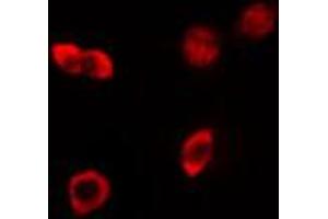 ABIN6274163 staining HeLa cells by IF/ICC.