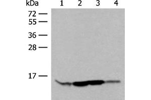 Western blot analysis of HL60 Hela 231 cell Human breast cancer tissue lysates using RPP14 Polyclonal Antibody at dilution of 1:400 (RPP14 Antikörper)
