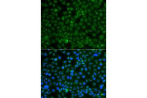 Immunofluorescence analysis of A549 cell using WDR45 antibody. (WDR45 Antikörper)