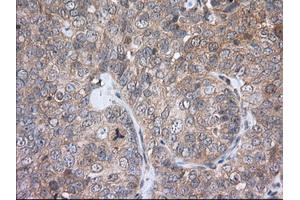 Immunohistochemistry (IHC) image for anti-phosphodiesterase 4A, CAMP-Specific (PDE4A) antibody (ABIN1500089)