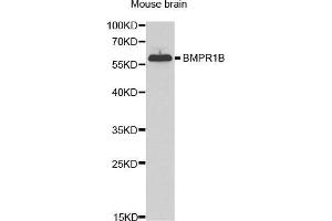 Western Blotting (WB) image for anti-Bone Morphogenetic Protein Receptor, Type IB (BMPR1B) (AA 1-126) antibody (ABIN6219169) (BMPR1B Antikörper  (AA 1-126))