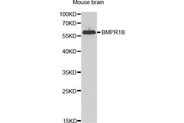 BMPR1B 抗体  (AA 1-126)