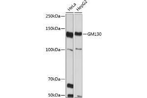 Western blot analysis of extracts of various cell lines, using GM130 Rabbit mAb (ABIN7267494) at 1:1000 dilution. (Golgin A2 (GOLGA2) Antikörper)