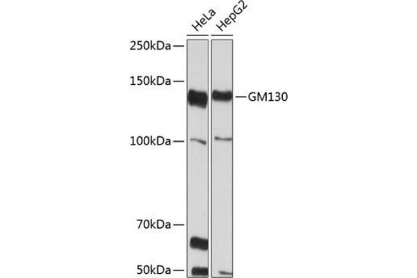 Golgin A2 (GOLGA2) Antikörper
