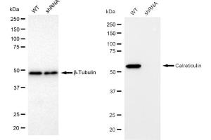 Western blotting analysis using Calreticulin antibody (ABIN7797853).