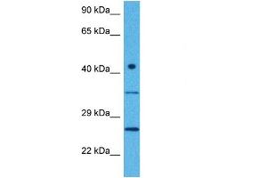 Host:  Rabbit  Target Name:  CTDNEP1  Sample Tissue:  Human MCF7 Whole Cell  Antibody Dilution:  1ug/ml