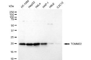 anti-Translocase of Outer Mitochondrial Membrane 22 Homolog (TOMM22) antibody
