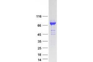 Validation with Western Blot (Menin Protein (Transcript Variant 2) (Myc-DYKDDDDK Tag))
